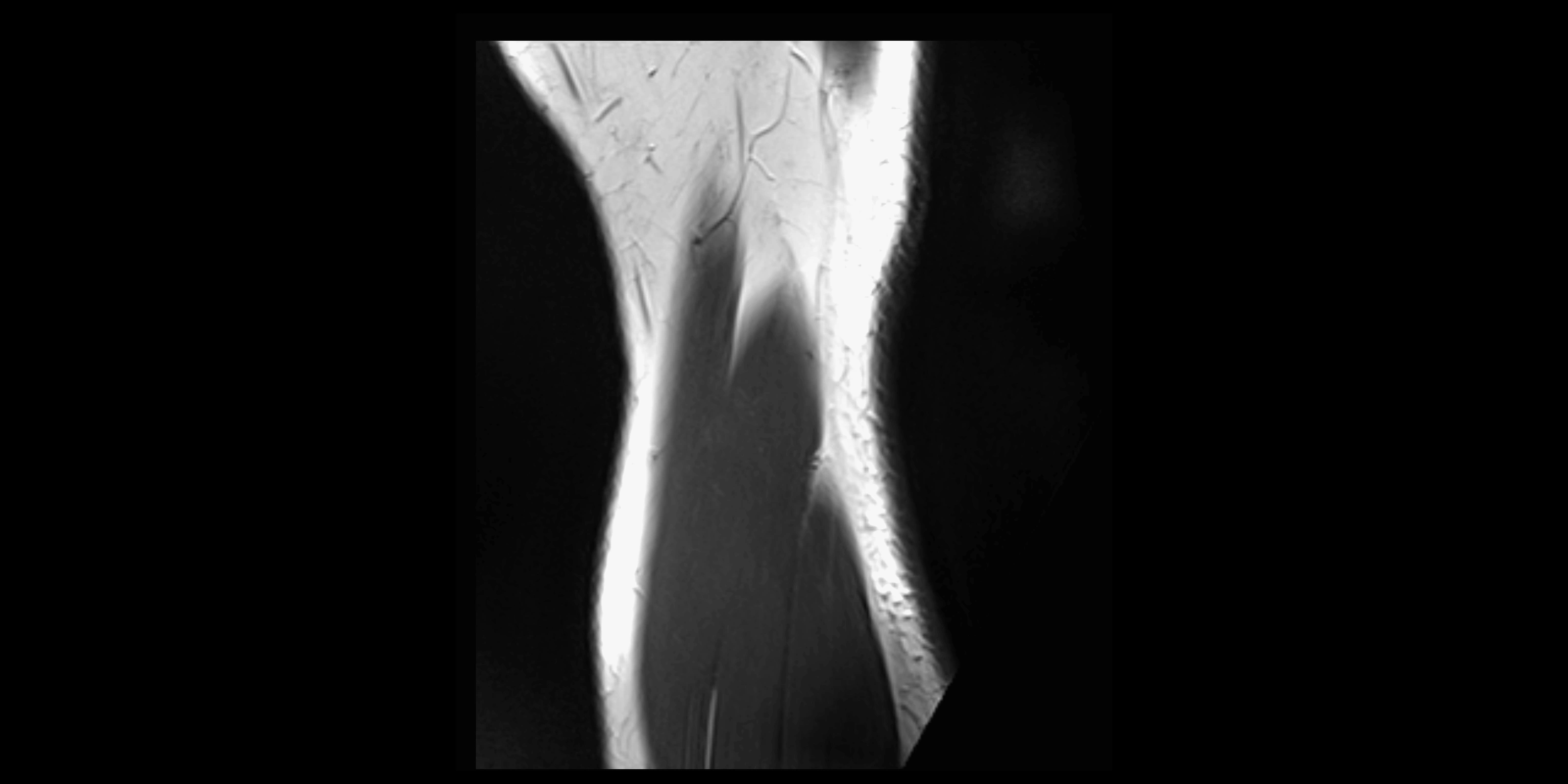 MRI elbow sagittal cross sectional anatomy 3T radiology  image-img-00001-00024.webp